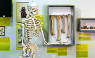 Oskar, das Skelett, besucht die Sonderausstellung «Gesundheit! 7000 Jahre Heilkunst» im Museum für Urgeschichte(n). Bild: Res Eichenberger, Museum für Urgeschichte(n) Zug.